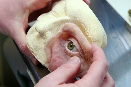 AL_MaxilloFacial_060314_12.jpg
