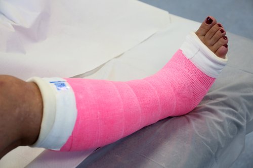 Lower Limb Cast