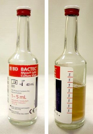 BACTEC Myco bottle and fill