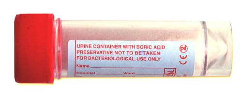 Boric-urine