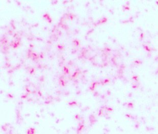 campylobacter faeces culture shigella salmonella notes stool gastroenteritis diarrhoea dysentry poisoning