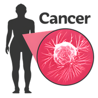 Silhouette of human body with magnified view of cancer cell.