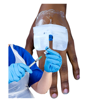 Close-up of a patient’s hand with an intravenous cannula inserted and secured with a clear dressing. A healthcare professional wearing blue gloves is holding a syringe and connecting it to the cannula port.