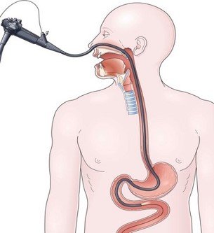Figure 1: Gastrointestinal tract