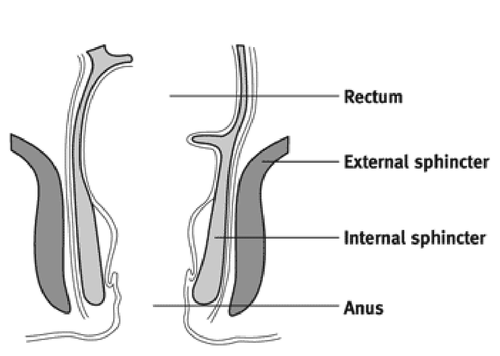 Figure 2: Diagram showing the side view of the sphincter muscle