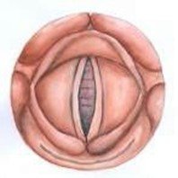 Figure 2: Vocal cords
