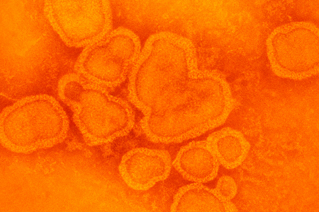 Flu virus with orange filter