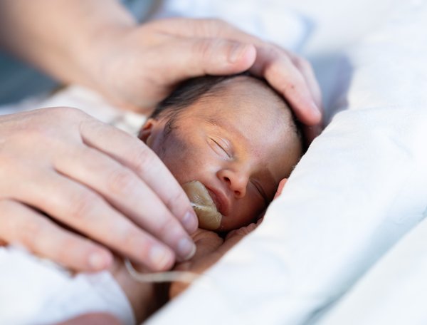 NICU