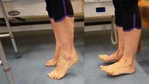 Heel and toes raises