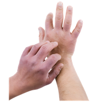 Close-up of one hand scratching the back of another hand, with visible redness and irritation.