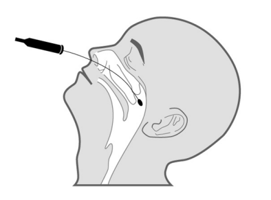 Pernasal Sampling