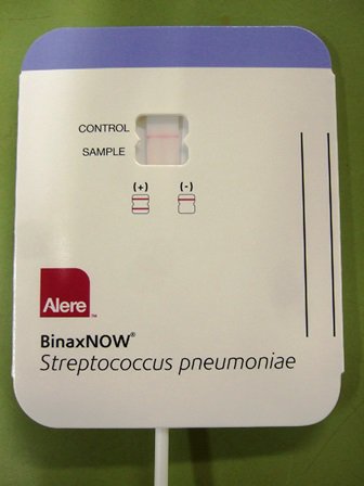 Pneumococcal antigen test