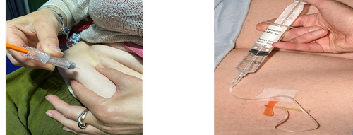 Prepare the needle and syringe