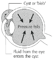 Pressure Falls