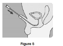 Pull the penis into an upright position