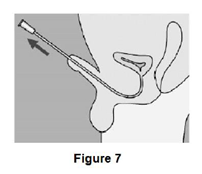 Pulling the penis upwards
