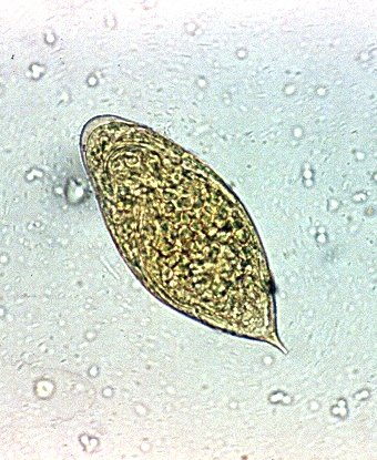 Bilharzia (Schistosomiasis) Microscopy, Urine