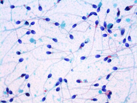 semen investigations fertility sperm count