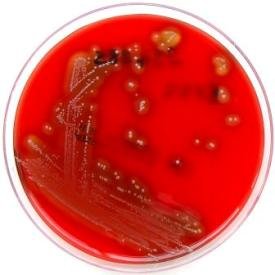 Streptococcus pyogenes (group a streptococcus)