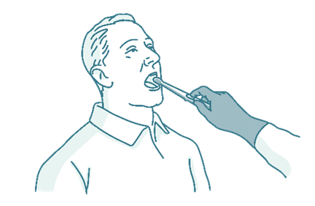 The nurse uses an applicator to place the capsule on the back of your tongue