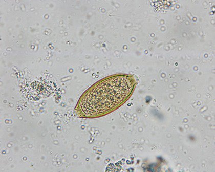 paraziták kezeléséből származó fekélyek pinworms felnőtteknél, ahol