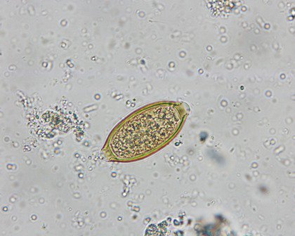 giardia cysts in human stool)