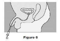 Urine will drain as you enter into the bladder