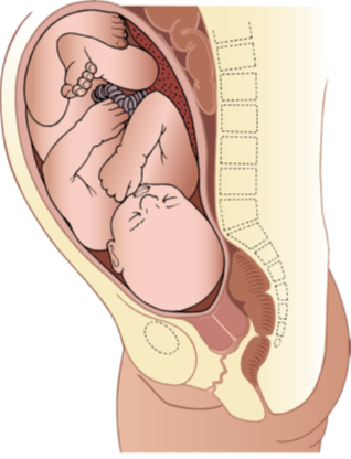 What is induction of labour