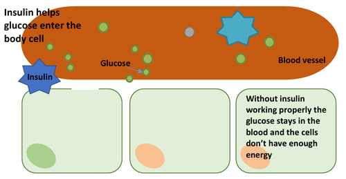 what is type 2 diabetes diagram